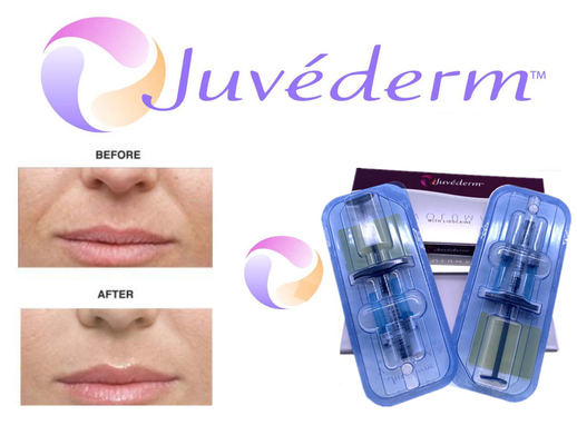 Yüz Kırışıklık Dolgusu İçin 2x1ml Çapraz Bağlantılı Juvederm Dermal Dolgu
