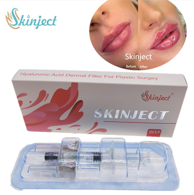 Enjekte Edilebilir Skinject Derin HA Dermal 2ml Dudak Dolguları Yanak Çene Nazolabial Kıvrım