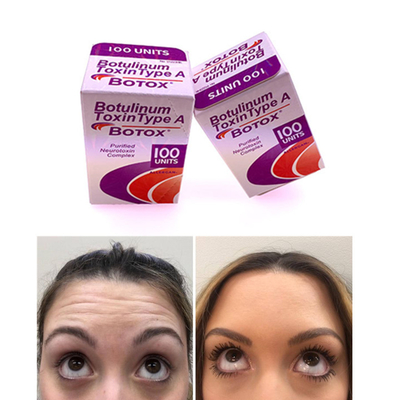 100 IU Allergan  Botulinum Toksin İngilizce Sürümü