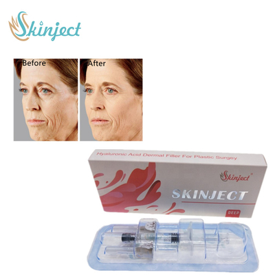Derin Yüz Kırışıklıkları ve Kıvrımları İçin Enjeksiyon Dermal Dudak Dolgusu