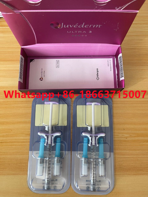 Dudak Burun İçin Juvederm Ultra3 Ultra4 Dermal Dolgu Enjeksiyonu Kırışıklıkları Giderir