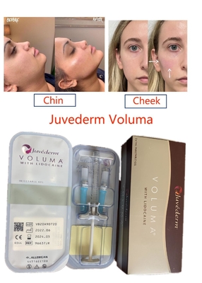 Juvederm Voluma Çapraz Bağlı Hyaluronik Asit Dolgu Uzun Ömürlü Yüz Saf Enjekte Edilebilir