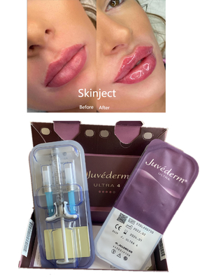 Lips Lido Ultra4 2X1ml ile Juvederm Hyaluronik Asit Dermal Dolguyu Yeniden Şekillendiriyor