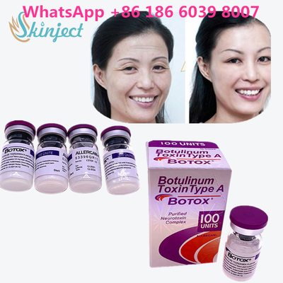 Botulinum Toxin  Kırışıklık Giderme 100u Allergan Yüz Germe Enjeksiyonu İçin 100 Adet