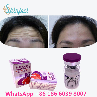 Botulinum Toxin  Kırışıklık Giderme 100u Allergan Yüz Germe Enjeksiyonu İçin 100 Adet