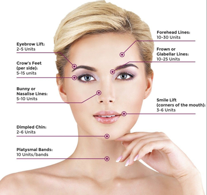 Alın Çizgileri Kırışıklık Karşıtı Botulax  Dermal Dolgu Maddeleri Yüz Gerdirme İçin Botulinum