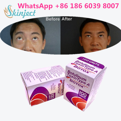 Yüz Kırışıklıkları İçin Botulinum Toxin Allergan s 1x100iu
