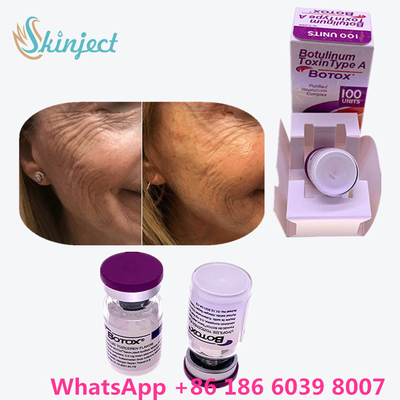 Botulinum Toxin Allergan  100 Iu 200ui 1 flakon / Kutu