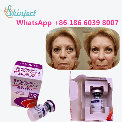 Cilt Yaşlanma Karşıtı Ürünler İçin Allergan Botoks Botulinum Toksin Tip A