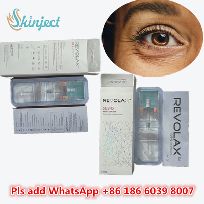 Hyaluronik Asit Kalem Dolgu KOEAR Revolax Hyaluronik Asit Dermal Yüz Plastik