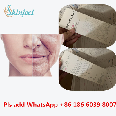 Hyaluronik Asit Kalem Dolgu KOEAR Revolax Hyaluronik Asit Dermal Yüz Plastik