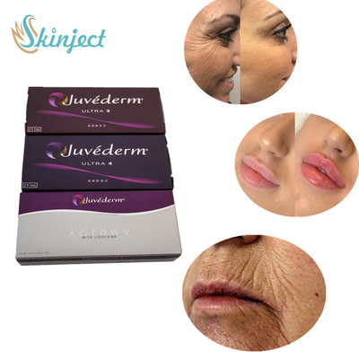 2 Ml Juvederm Çapraz Bağlı Hyaluronik Asit Dolgu Ultra 3 Ultra 4 Volume