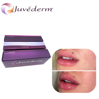Juvederm Hiyaluronik Asit Dudak Genişletme Dermal Dolgu Burnunu kaldırma Doldurma Yüzü için kalıcı