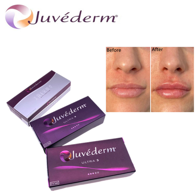 Hyluronic Acid Dermal Filler Premium Juvederm HA Yüz Filler Ultra3 Ultra4 Voluma Yüz Yenilenmesi İçin