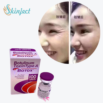 100 Ünite Tip A Botulinum Toksini 2 - 8°C Saklama Sıcaklığı