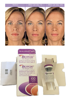 Enjeksiyonlar Allergan Botulinum Toxin 100IU Anti kırışıklık Dermal Filler