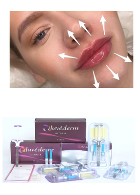 Juvederm' Hiyaluronik Asit Dermal Filler Ultra3 Ultra4 Dudak Doldurma için Hacim Enjeksiyonu