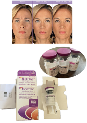 Anti kırışıklık  Botulinum Toxin Allergan 100IU 150iu ' Na