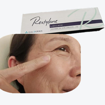 2*1ml/ Kutusu Hyaluronik Asit Göğüs Doldurucu HA Alın çizgileri için Dermal Doldurucular