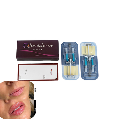 Juvederm Dermal Filler For Lips Enjeksiyonlu Hiyaluronik Asit Fillers