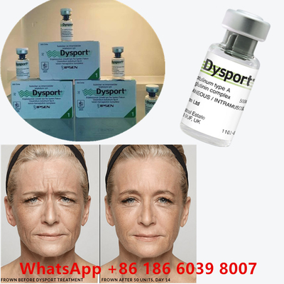 Botulinum Toksin 100 Birim BTX Enjeksiyon Tip A Kozmetik Kullanım
