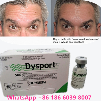 Botulinum Toksin 100 Birim BTX Enjeksiyon Tip A Kozmetik Kullanım