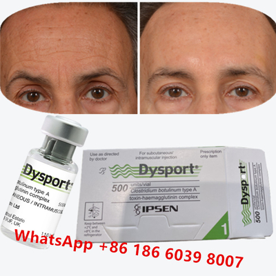 Botulinum Toksin Dysport Clostridium Botulinum Tip A Karga Ayakları İçin