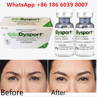 Botulinum Toxin Dysport 100u Clostridium Botulinum Tip A Alın kırışıklıkları için