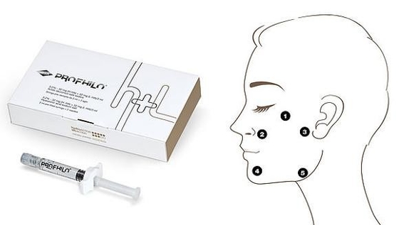 Kolajen uyarımı Profhilo Enjekte edilebilir Dermal Filler Beş Noktalık kaldırma