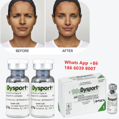 Dysport Botulinum Toksin Tipi A, Kaşları ve Glabellar çizgileri için