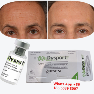 Dysport Botulinum Toksin Tipi A, Kaşları ve Glabellar çizgileri için