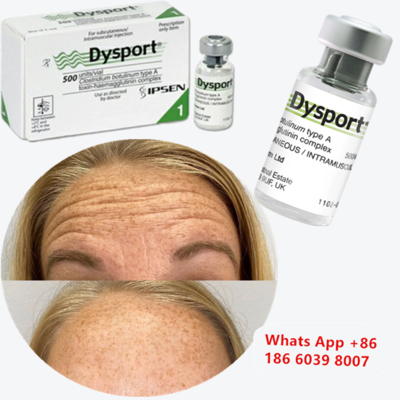 Dysport Botulinum Toxin Tip A, kırışıklık azaltma enjeksiyonu
