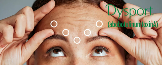 Enjeksiyonluk Dysport 500 abobotulinumtoksinA Botox 500U