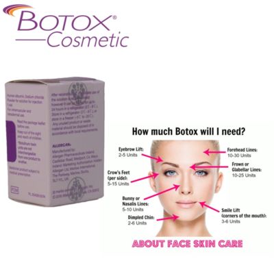 Allergan Botox 100IU Botulinum Toksin, 3 Yıl Raf Ömrü ve 4-8 Ay Etki Süresi
