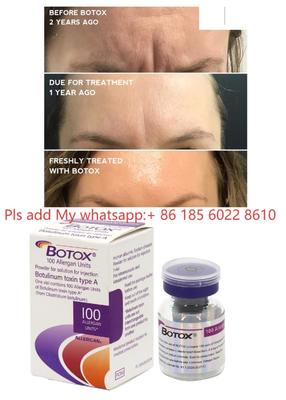 Allergan Botox 100IU Dysport Enjeksiyon Botulax Botulinum Toksin Kırışıklıkları Giderir