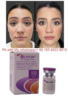 Botulax Botulinum Toksin Dysport Allergan Botox Kırışıklık Azaltma ve Kozmetik