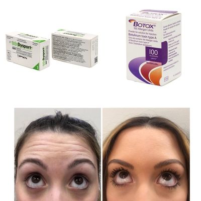 100 Birim Kore BTX kırışıklıklar ve ince çizgiler için botulinum toksin