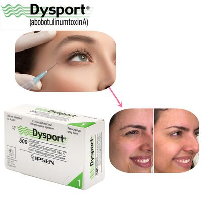 500u Dysport Yüz kırışıklığı yok oluşu Dondurulmuş toz işleme Özel OEM Dysport