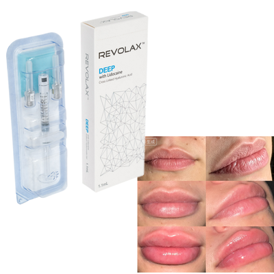 Revolax Hyaluronik Asit Dolgu Doğal Dolgun Dudak Dolgusu Yüz Hacim Yenileme