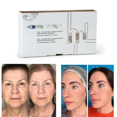 Profhilo Tedavisi Hyaluronik Asit Cilt Güçlendirici & Bio-Remodeling