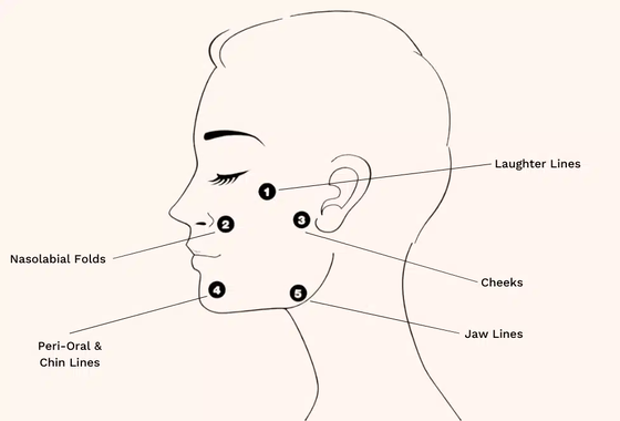 Profhilo Tedavisi Hyaluronik Asit Cilt Güçlendirici & Bio-Remodeling