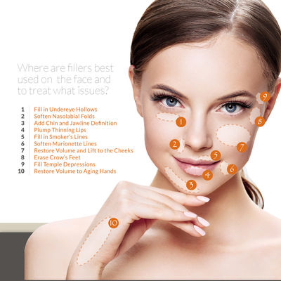 Skinject Hyaluronik Asit Jel Dolgu Enjeksiyonu Alın Kırışıklığını Giderme