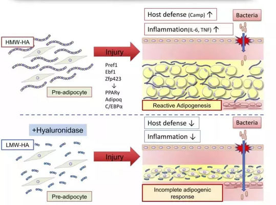 Yağ Yakımı İçin Limon Şişe Lipolitik Çözelti Enjeksiyonu