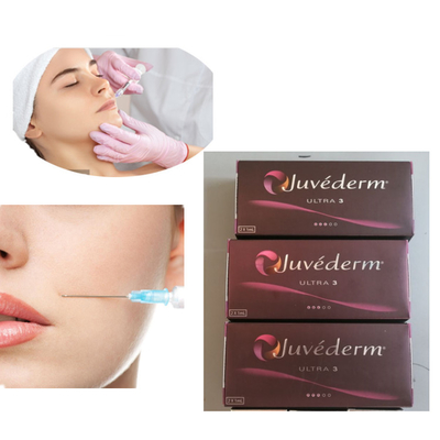 Enjeksiyon Juvederm 2x1ml Ultra 3 Dudak Dermal Dolgu 24mg/Ml