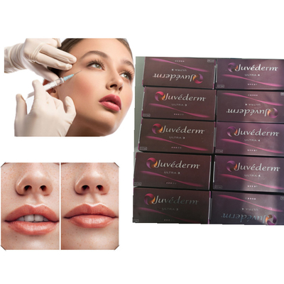 Dudak Jel Dolgusu Hyaluronik Asit Dermal Dolgu Juvederm Ultra 3 Ultra 4