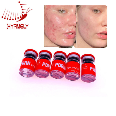 3 Ml Microneedle Enjeksiyon Cilt Güçlendirici PDRN Serum Cilt Onarımı