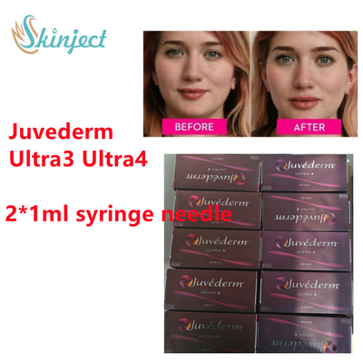 Juvederm Hyaluronik Asit Dermal Dolgu Maddesi Juvederm Lidokainli Dudak Dolgusu 2x1ml Ultra3 Ultra4