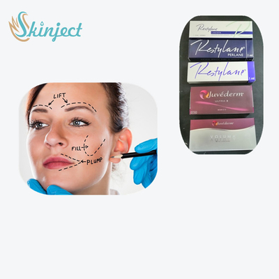 Juvederm Smile Line Öncesi ve Sonrası Gözyaşı Olukları İçin Enjekte Edilebilir Dermal Dolgu