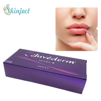 Dudaklar için Juvederm Ultra 4 Dermal Dolgu Cilt Dermal Dolgu Hyaluronik Asit Dermal Dolgu