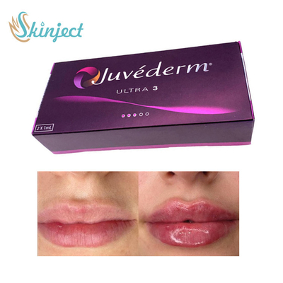 281ML Hyaluronik Asit Dudak Dolgusu Juvederm Ultra3 Dermal